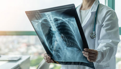 X-Ray
